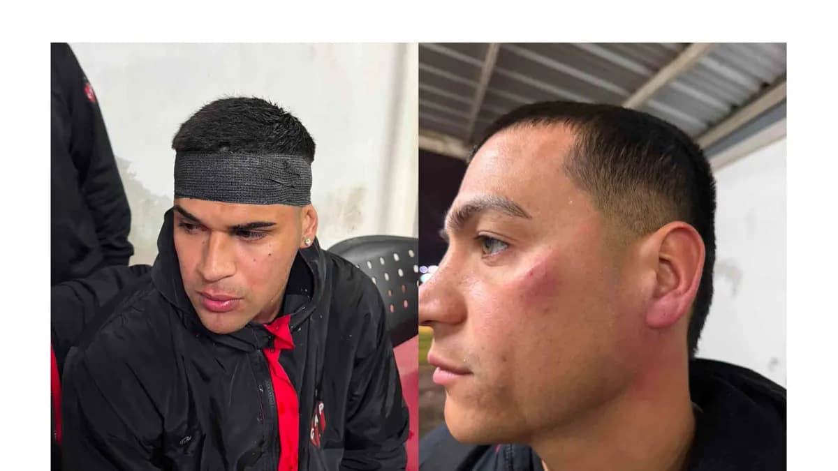 Tras perder con Colón, los jugadores de Patronato fueron agredidos en su llegada al club - imagen de origen